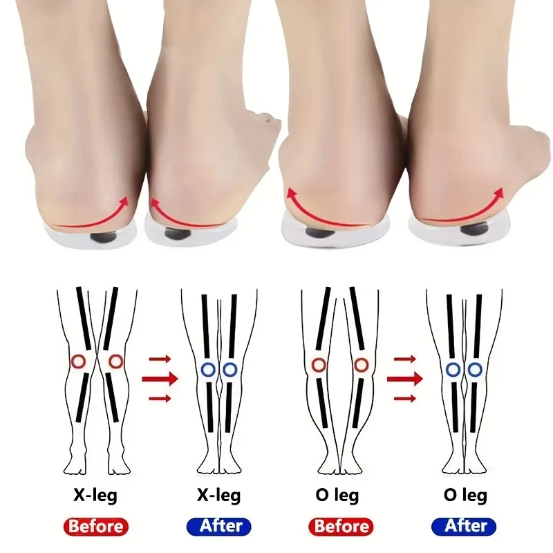 1 para wkładek ortopedycznych  – Women Shoes Types recenzja i cena